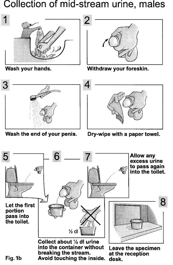 Male urine collection