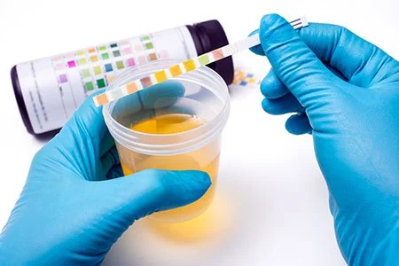 Urine sample